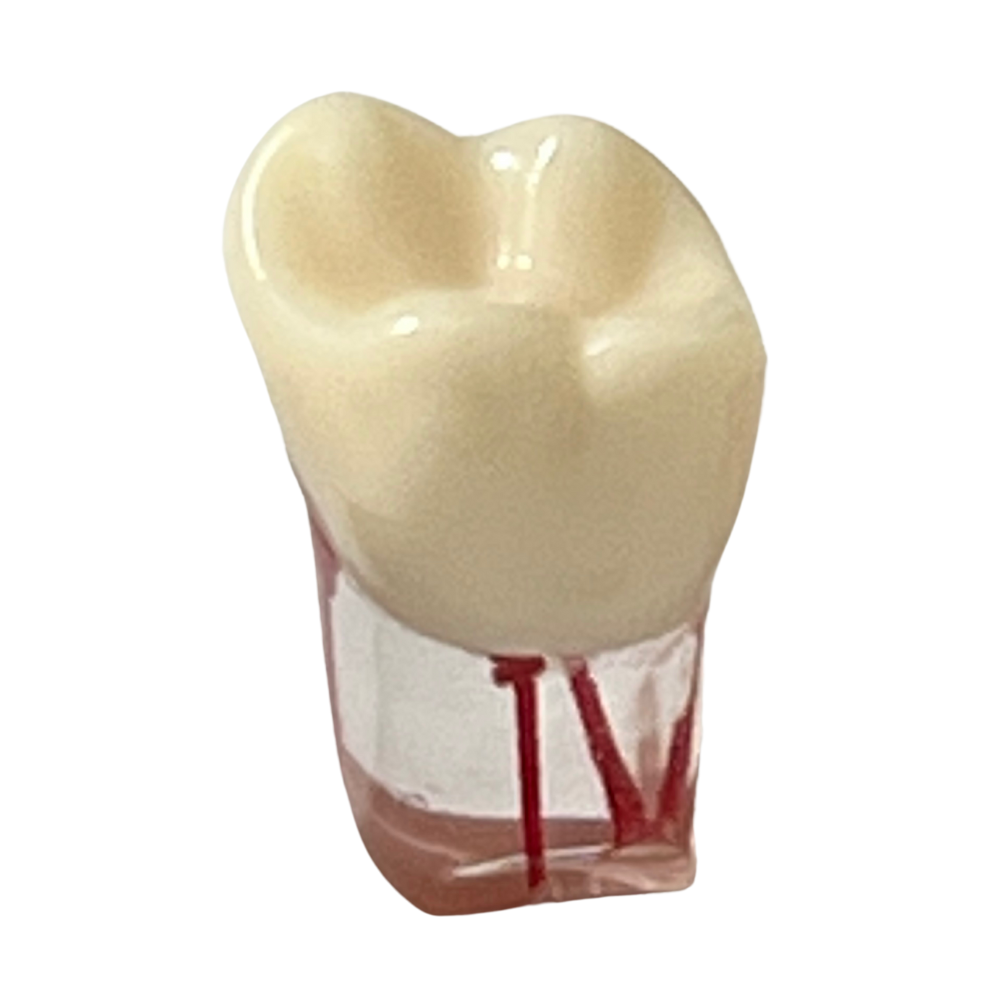 Dientes Endodoncia C/5 P/ modelo 28 dientes DT (Tipo Nissin)