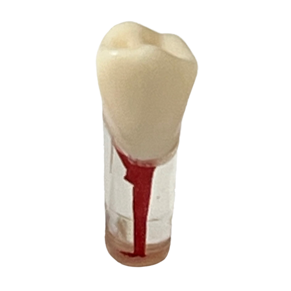 Dientes Endodoncia C/5 P/ modelo 28 dientes DT (Tipo Nissin)